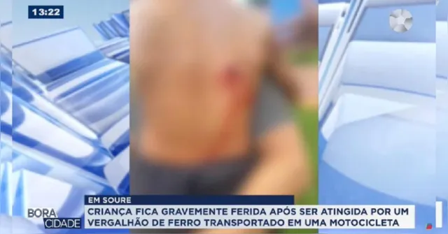 Imagem ilustrativa da notícia Criança é atingida por vergalhão transportado em moto no Marajó