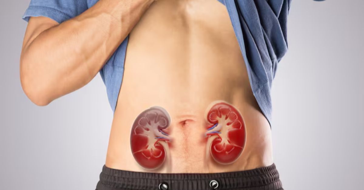 A obesidade aparece como uma nova vilã para doença renal