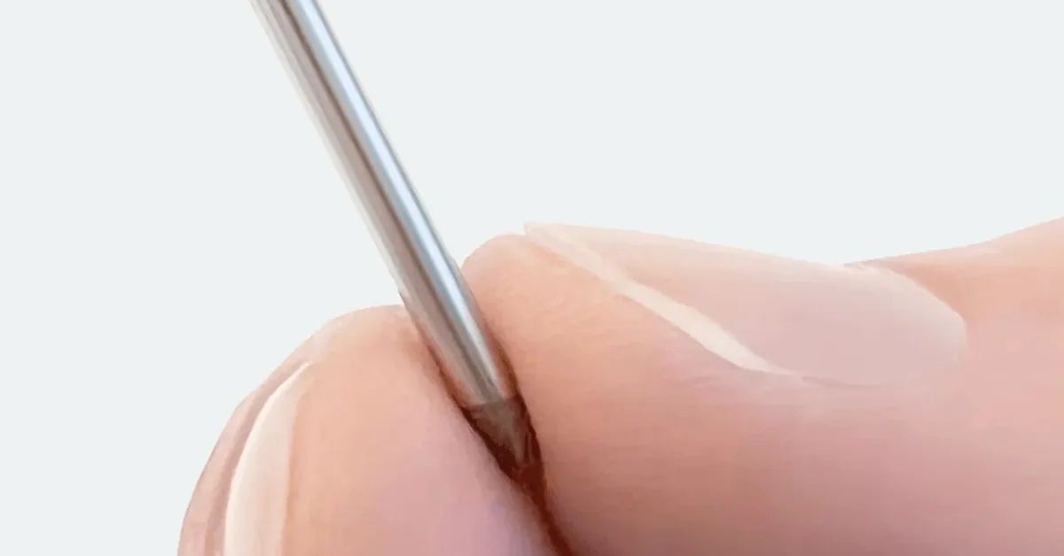 A Vivani Medical está desenvolvendo um implante subcutâneo de pequenas dimensões capaz de liberar semaglutida de forma contínua por, no mínimo, seis meses.