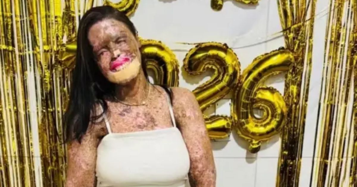 A influenciadora recebeu o diagnóstico de xeroderma pigmentoso, condição que deixa a pele extremamente sensível à luz solar. A doença provoca predisposição ao câncer de pele, conforme relatos da própria jovem sobre sua rotina de tratamentos.