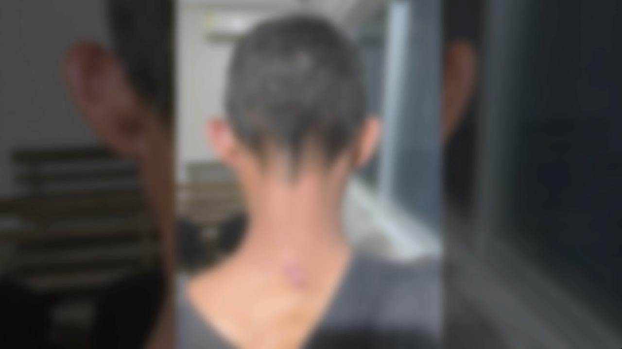 Homem sofreu ferimento na cabeça e nuca devido o golpe recebido com a pá