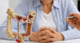 O FIT apresenta sensibilidade estimada entre 85% e 92% para identificar possíveis alterações