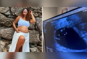 Superfetação é um fenômeno extremamente raro associado à ocorrência de uma nova concepção durante uma gravidez; Thaís deu à luz três meninas após descobrir que esperava inicialmente gêmeos.
