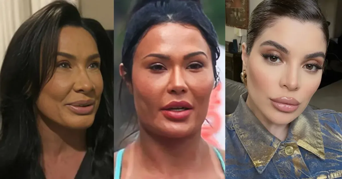 Famosas como Scheila Carvalho, Gkay e Deborah Secco reverteram procedimentos estéticos após se incomodarem com os resultados e passaram a buscar uma aparência mais natural.