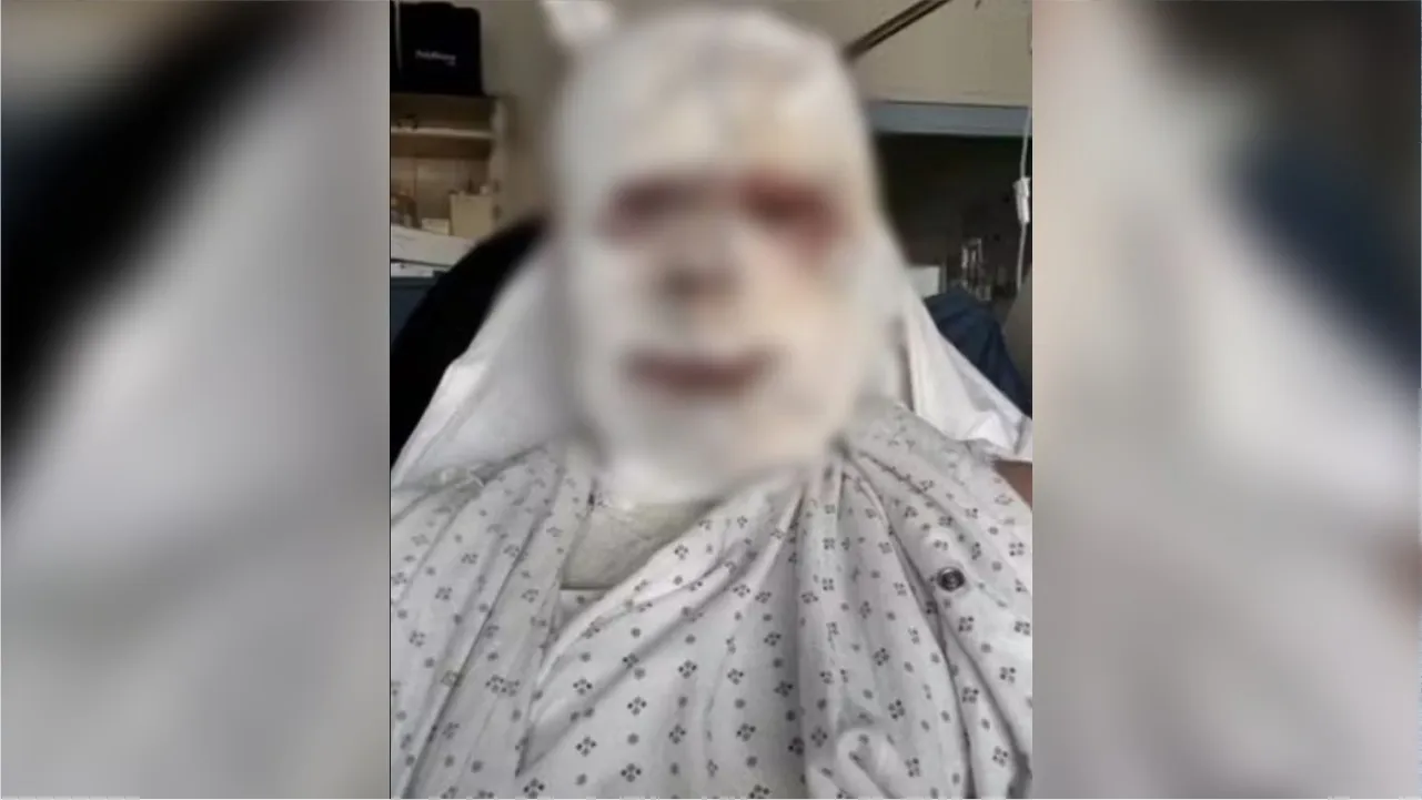 O empresário australiano Callum Forbes, que sofreu queimaduras de segundo grau no rosto e graves ferimentos pelo corpo após ser atacado enquanto dormia.