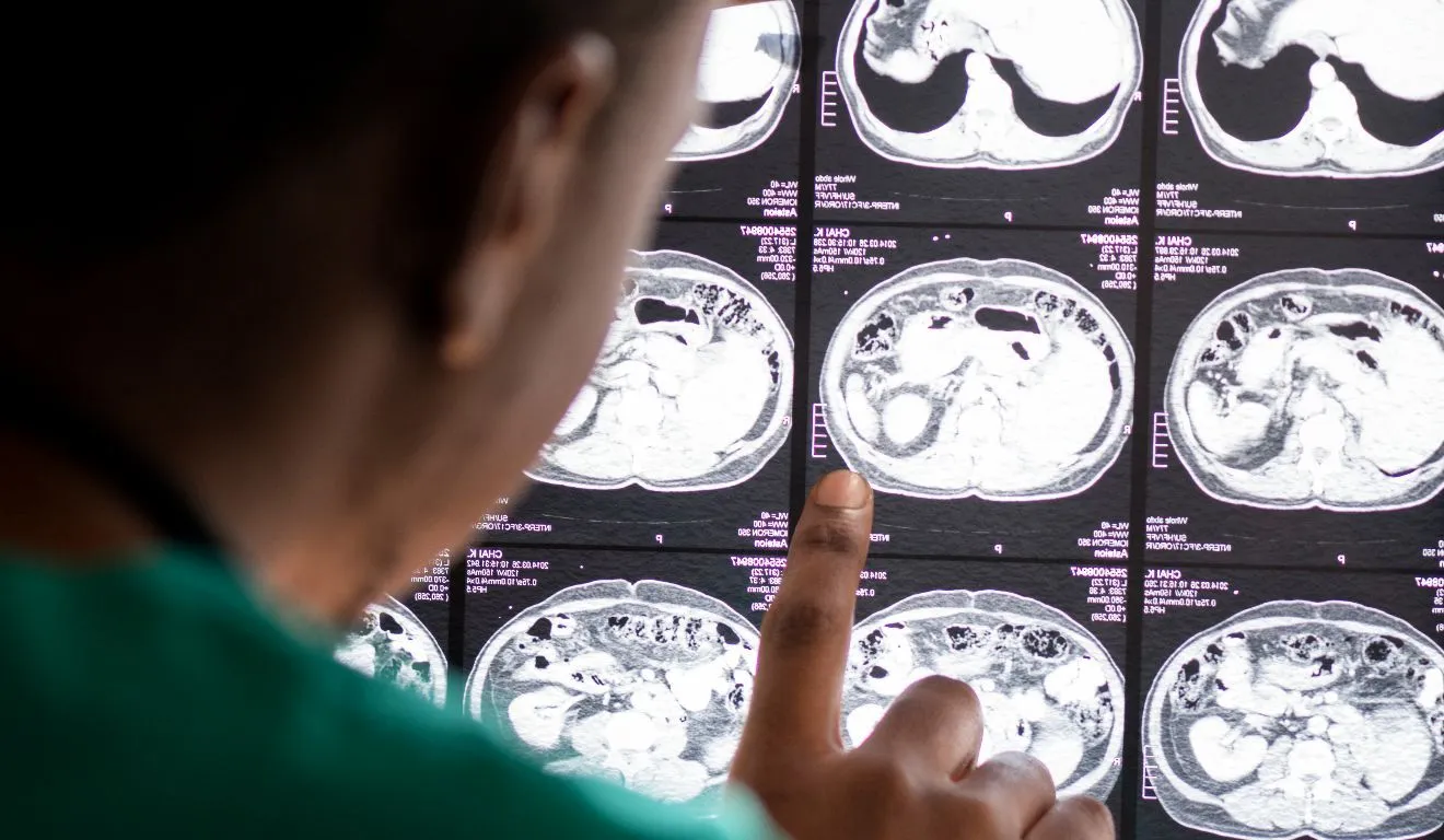 Apesar do avanço, a estratégia ainda está em fase de pesquisa e não pode ser considerada um tratamento comprovado para o Alzheimer.