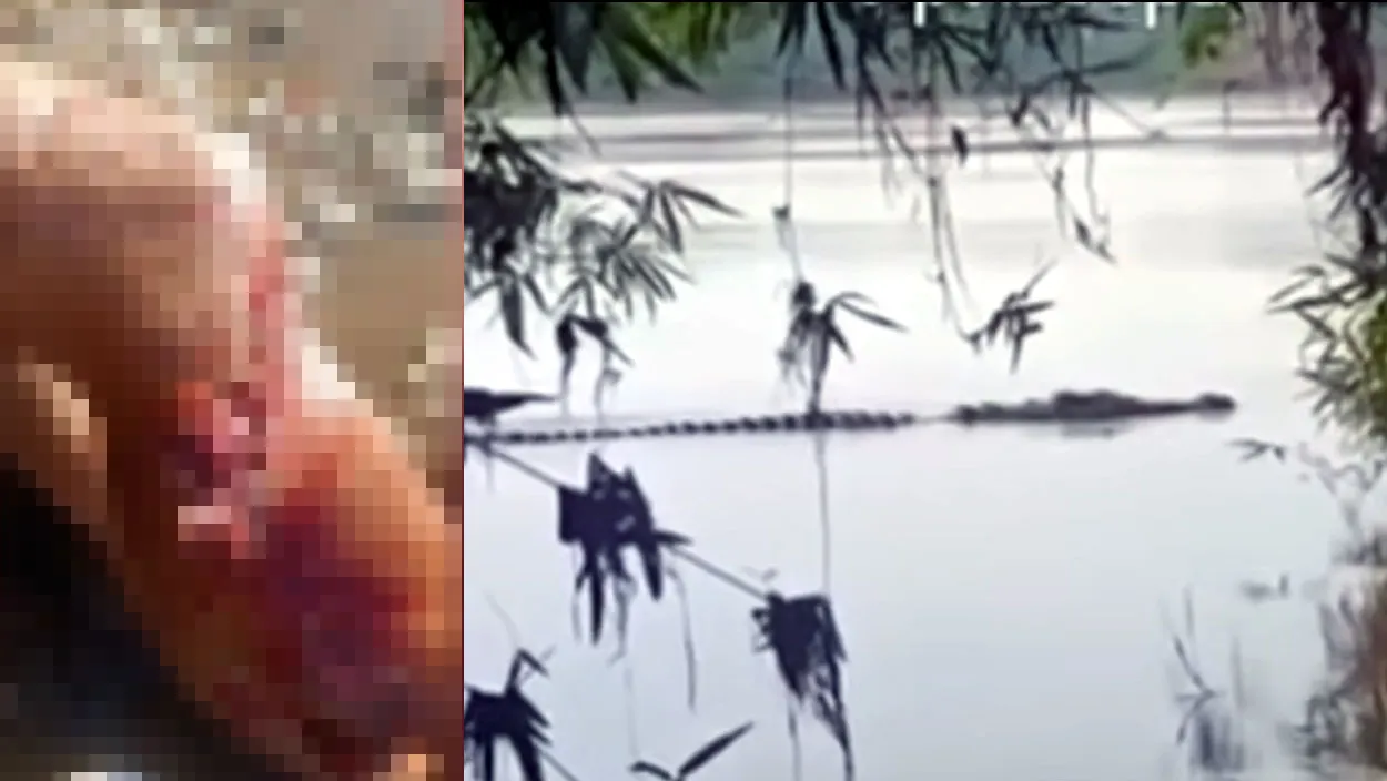 O pescador teve a perna dilacerada devido o ataque do jacaré
