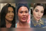 Famosas como Scheila Carvalho, Gkay e Deborah Secco reverteram procedimentos estéticos após se incomodarem com os resultados e passaram a buscar uma aparência mais natural.