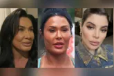Famosas como Scheila Carvalho, Gkay e Deborah Secco reverteram procedimentos estéticos após se incomodarem com os resultados e passaram a buscar uma aparência mais natural.