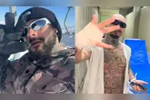 O streamer mostrou foto da mão após ter o dedo decepado