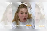 Virginia Fonseca revelou que retomou o tratamento com 31 aplicações de botox para controlar crises de enxaqueca.