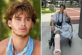 Após o acidente, o participante ficou internado por mais de dois meses em um hospital em Miami, nos Estados Unidos.