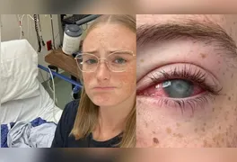 Norte-americana desenvolveu infecção rara por ameba e alerta para os riscos de expor o acessório à água do chuveiro.