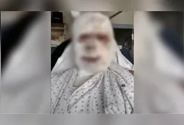 O empresário australiano Callum Forbes, que sofreu queimaduras de segundo grau no rosto e graves ferimentos pelo corpo após ser atacado enquanto dormia.