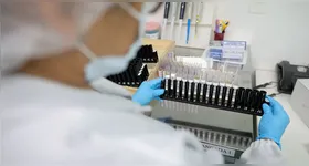 O Ministério da Saúde detalhou que a dose, chamada Vivaxin, é fruto de pesquisas