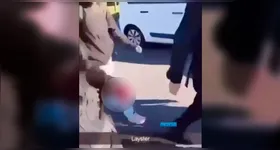 O adolescente perdeu a mão esquerda após a explosão