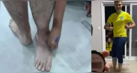 O brasileiro Renato Bayma Gaia entrou para o Guinness World Records após alcançar uma marca impressionante: ele conseguiu girar o próprio pé em 210,66 graus.