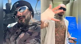 O streamer mostrou foto da mão após ter o dedo decepado