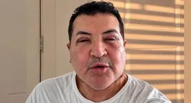 O artista afirmou que a aparência deve mudar ao longo dos próximos meses, até que o inchaço diminua completamente.