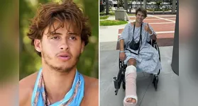 Após o acidente, o participante ficou internado por mais de dois meses em um hospital em Miami, nos Estados Unidos.