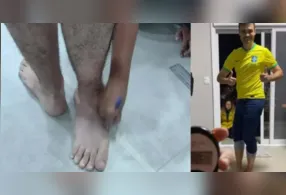 O brasileiro Renato Bayma Gaia entrou para o Guinness World Records após alcançar uma marca impressionante: ele conseguiu girar o próprio pé em 210,66 graus.
