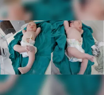 Imagem ilustrativa da imagem Recém-nascido dá show de tranquilidade e viraliza após parto; veja o vídeo