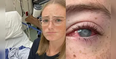 Imagem ilustrativa da imagem Jovem perde a visão após tomar banho usando lentes de contato