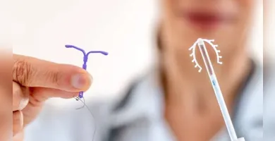 Imagem ilustrativa da imagem Planos terão de cobrir DIU para casos de endometriose