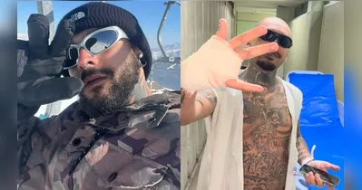 O streamer mostrou foto da mão após ter o dedo decepado