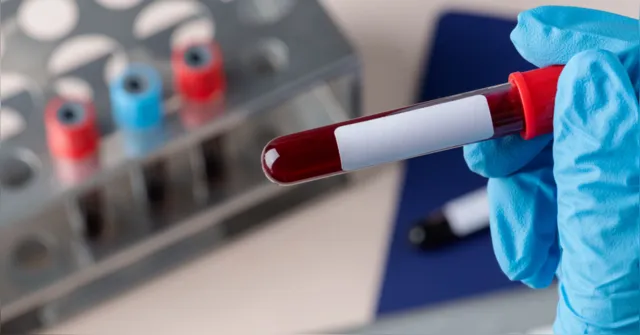 Imagem ilustrativa da notícia Exame de sangue para detectar mais de 50 tipos de câncer chega ao Brasil