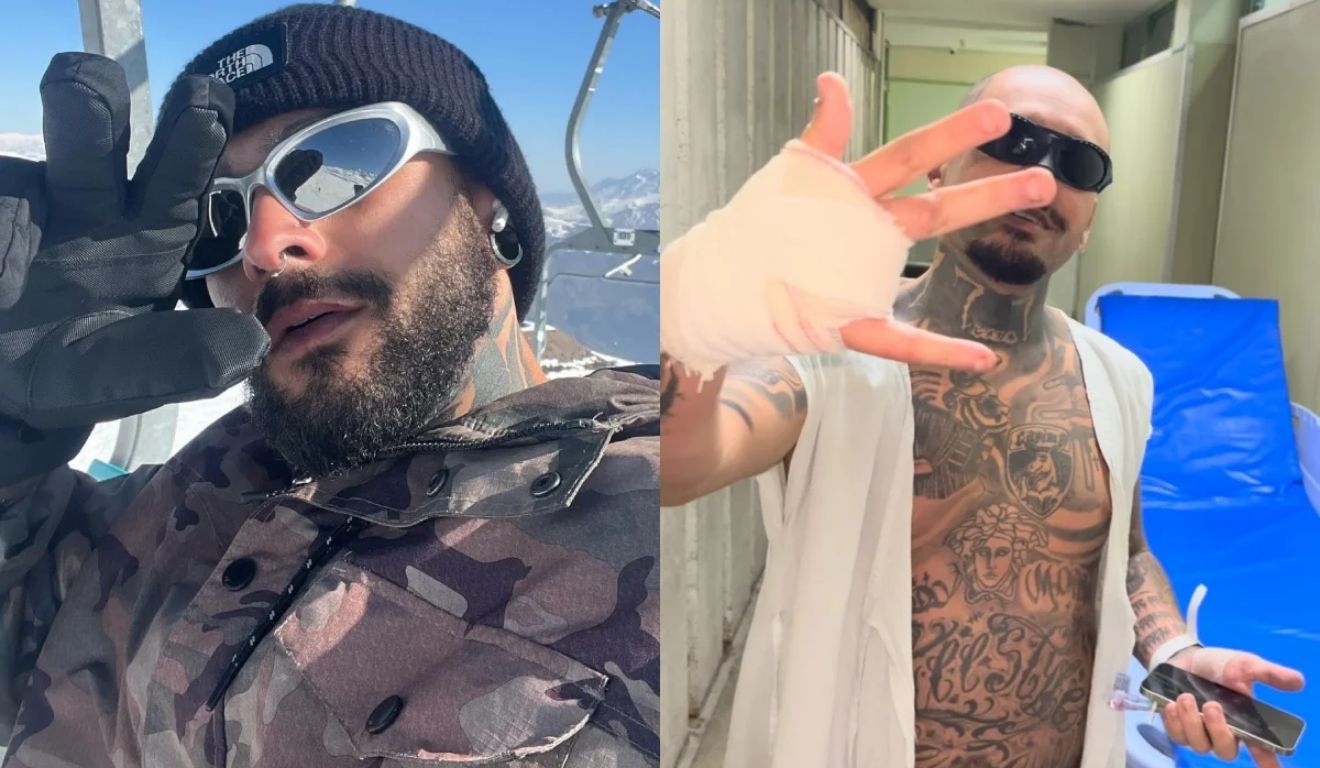 O streamer mostrou foto da mão após ter o dedo decepado