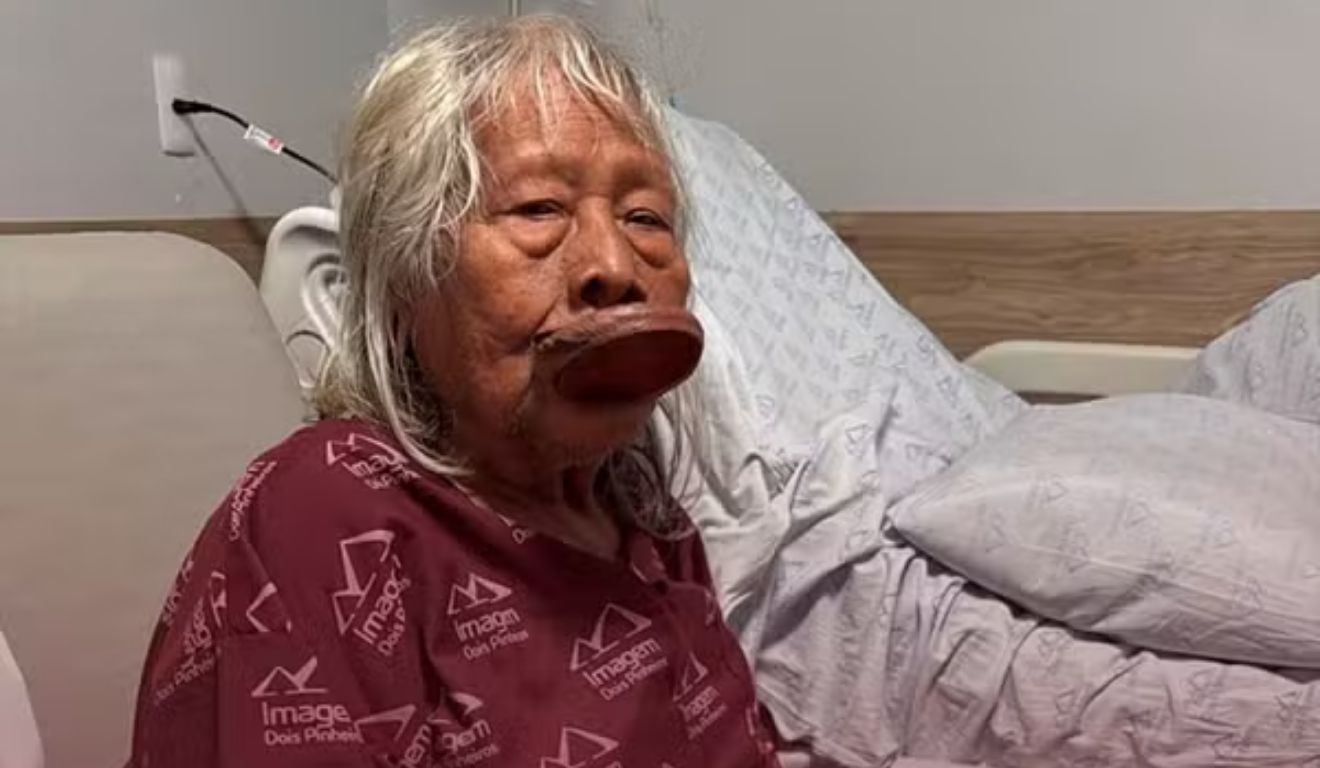 O cacique conhecido pela luta indígena segue em estado de saúde delicado