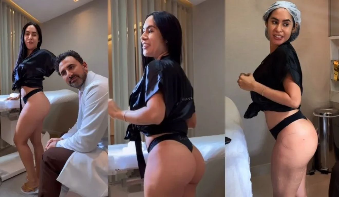 A ex-BBB e cunhã-poranga Isabelle Nogueira mostra procedimento no bumbum.