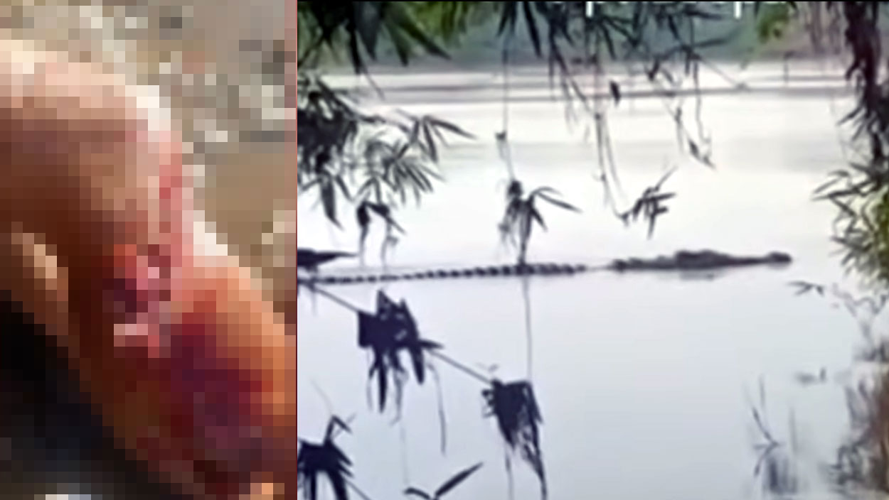O pescador teve a perna dilacerada devido o ataque do jacaré