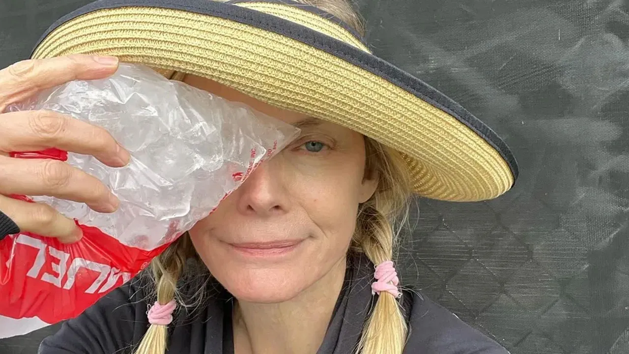 Imagem ilustrativa da notícia: Michelle Pfeiffer aparece de olho roxo e publica alerta