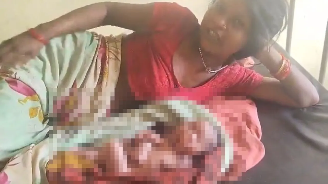 Imagem ilustrativa da notícia: Bebê nasce com 4 braços, 4 pernas e duas cabeças na Índia 