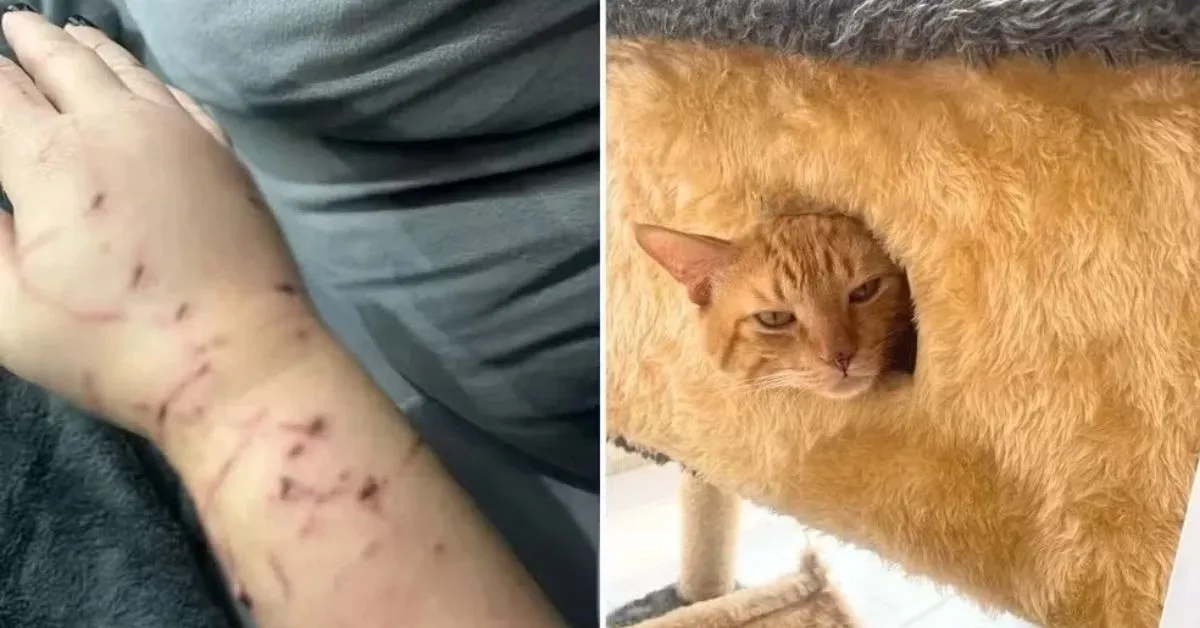 Imagem ilustrativa da notícia: Gato ataca dona e faz família "refém" dentro de casa