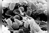 Imagens da bactéria Yersinia pestis causadora da peste negra