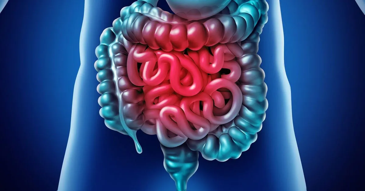 Imagem ilustrativa do podcast: Saiba quando o desconforte intestinal é sinal de alerta