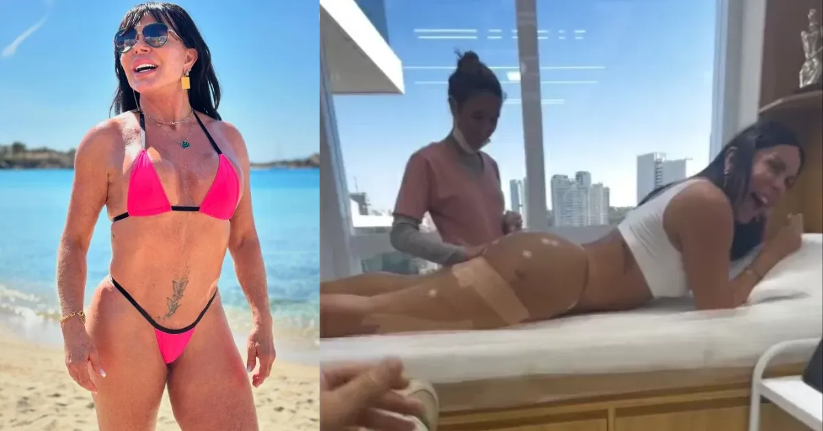Imagem ilustrativa da notícia: Gretchen mostra harmonização no bumbum e recebe elogios