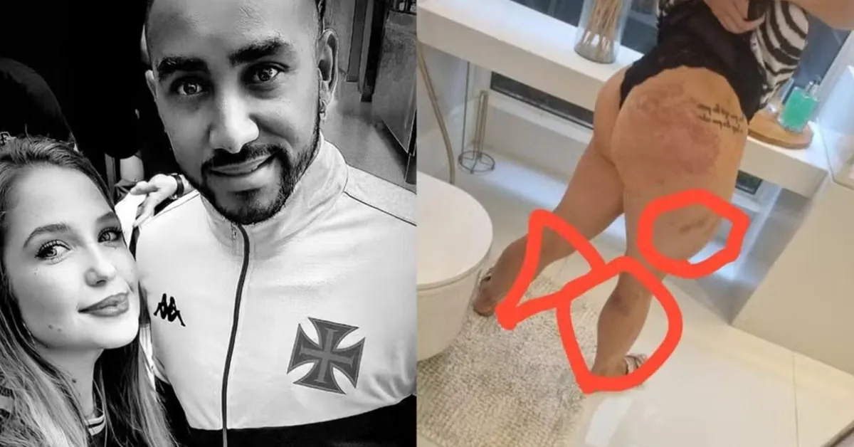 Imagem ilustrativa da notícia: Payet nega agressão e diz que beber urina era comum