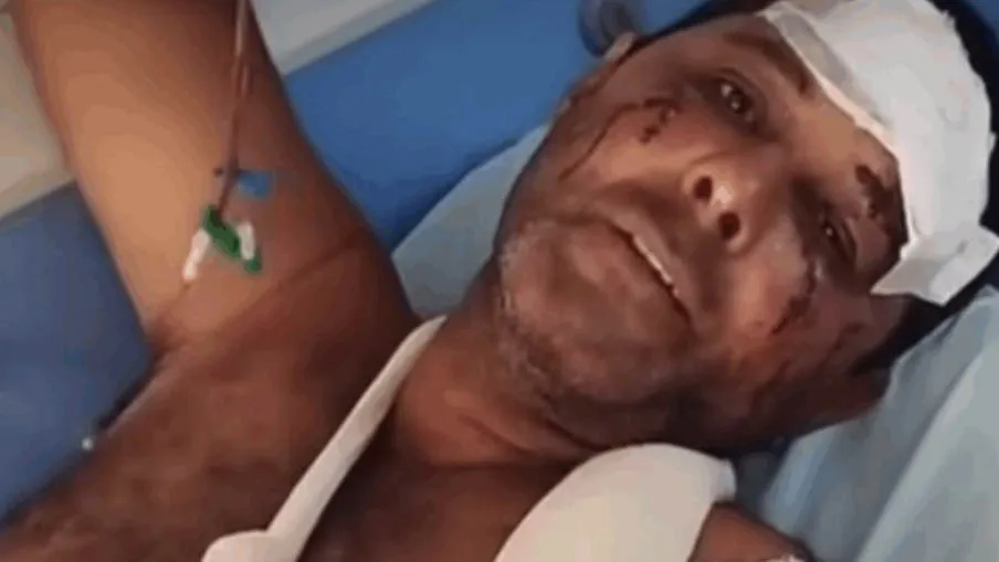 Imagem ilustrativa da notícia: Homem de 51 anos é ferido em ataque raro de onça no interior