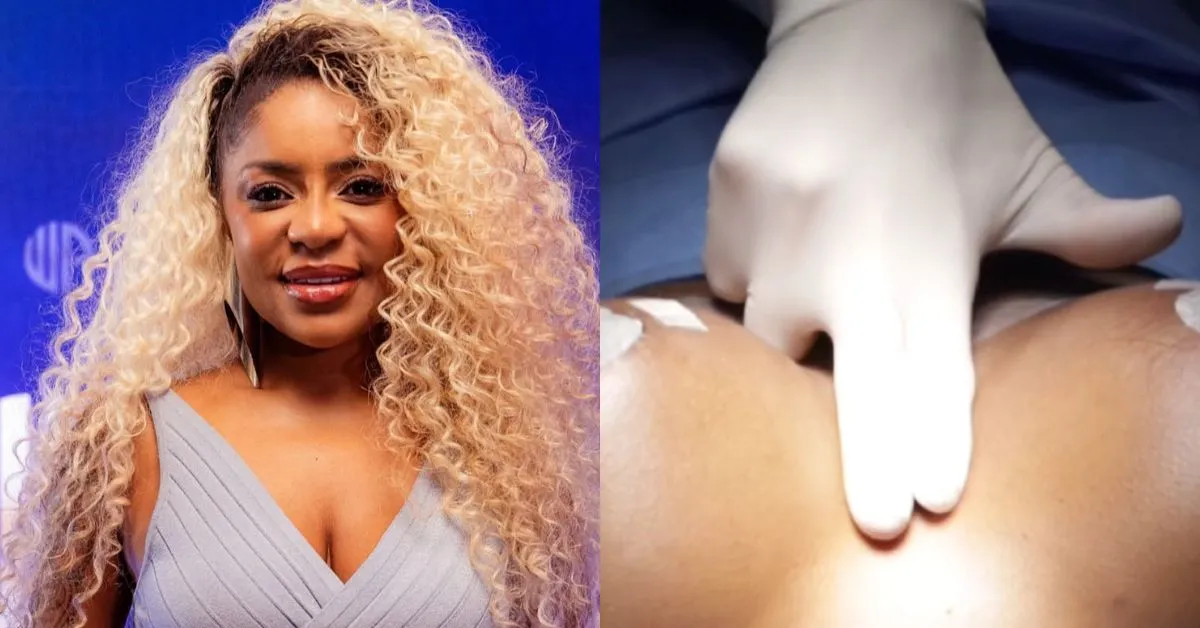 Imagem ilustrativa da notícia: Cariúcha deixa de ser “toda natural” e exibe resultado de silicone