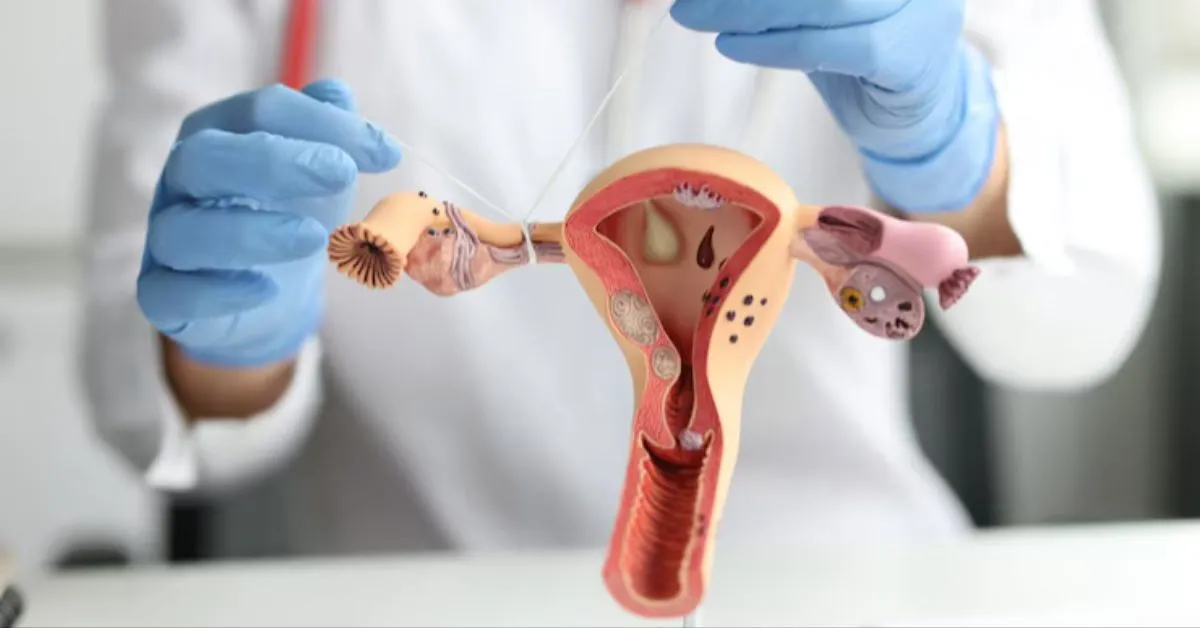 Imagem ilustrativa da notícia: Infecção genital por bactéria que 'come carne' chocam médicos