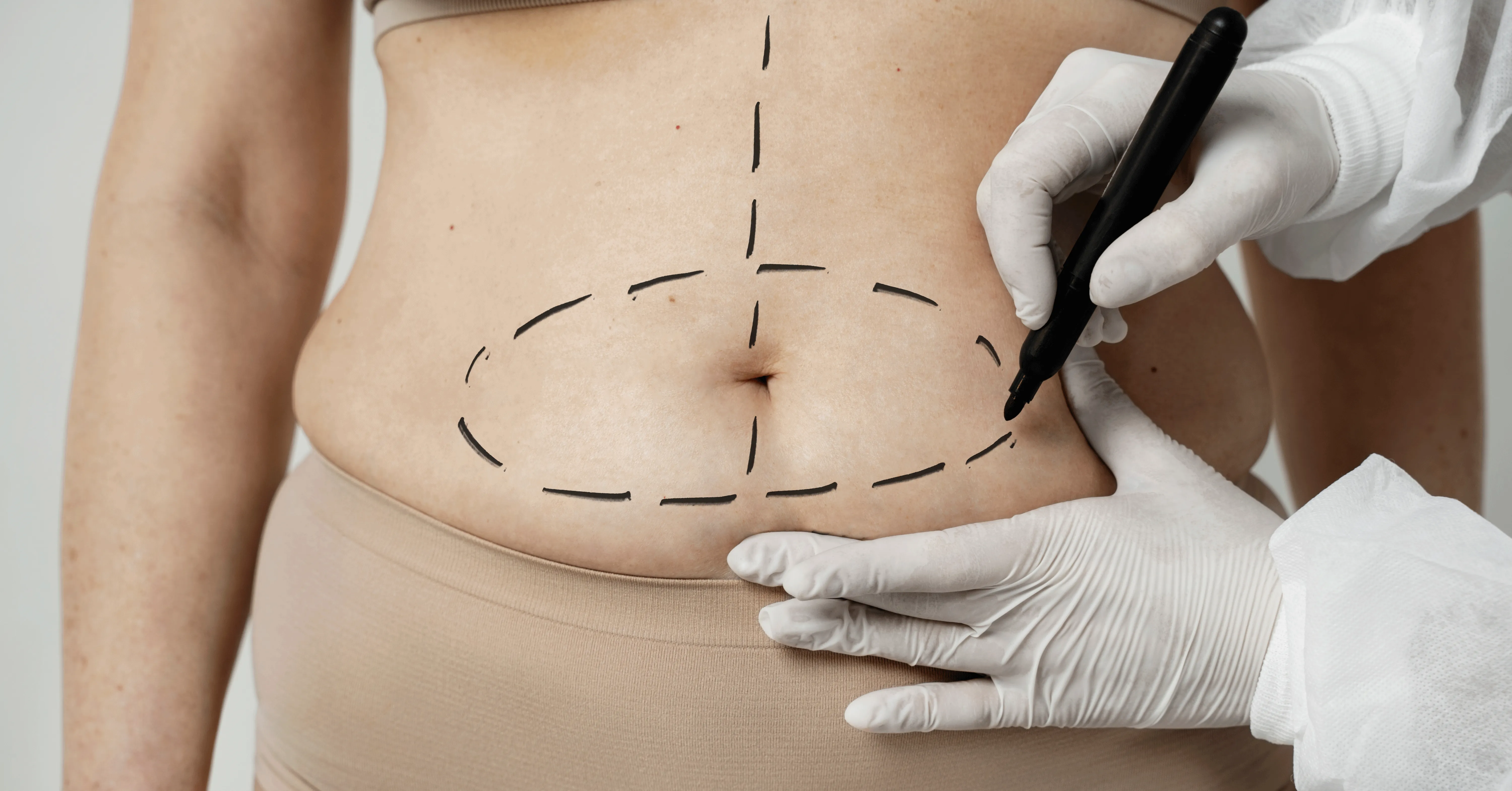 Imagem ilustrativa da notícia: Webinar Dr. Responde esclarece dúvidas sobre cirurgia bariátrica e metabólica