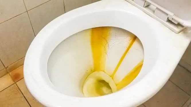 Imagem ilustrativa da notícia: Como eliminar manchas amarelas do vaso sanitário