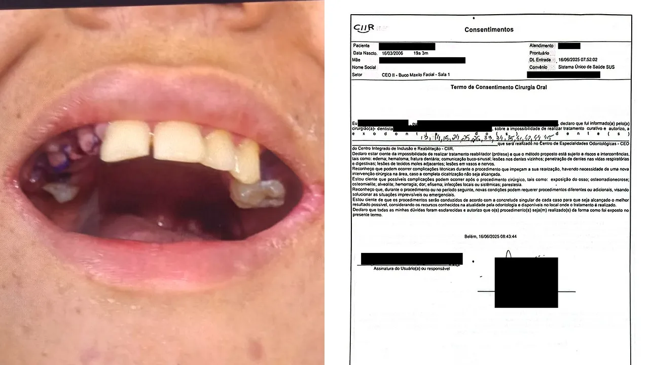 Imagem ilustrativa da notícia: Extração de dentes de jovem autista foi autorizada, aponta documento