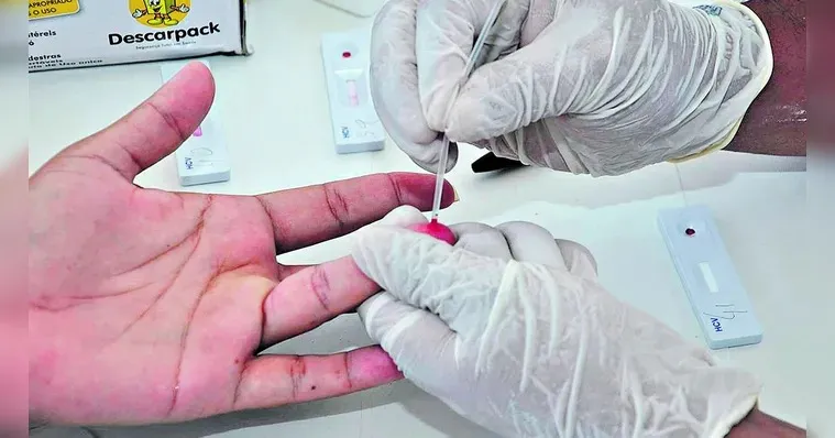 Imagem ilustrativa da notícia: Região Norte tem alta incidência de Hepatite D; sintomas e como prevenir