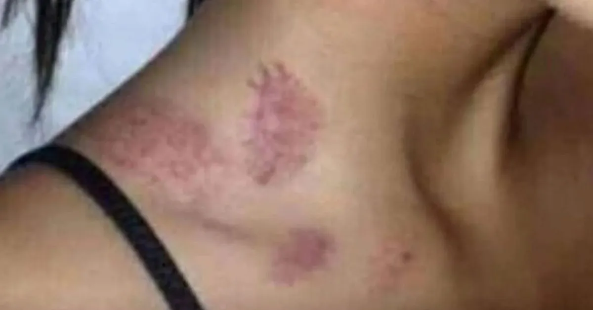 Imagem ilustrativa da notícia: Mulher em Paragominas diz ter sido atacada por 'lobisomem'