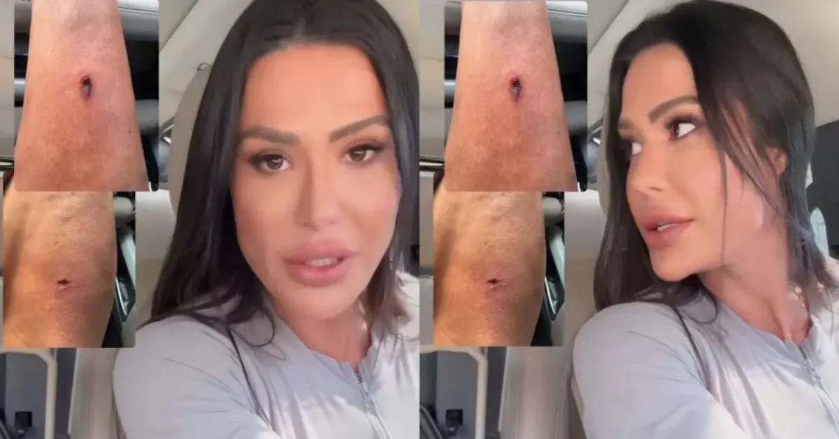 Imagem ilustrativa da notícia: Gracyanne Barbosa sofre acidente durante treino na academia